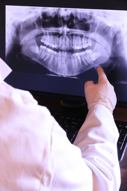 Best Urgent Care for Lost Fillings or Crowns in New Boston, OH